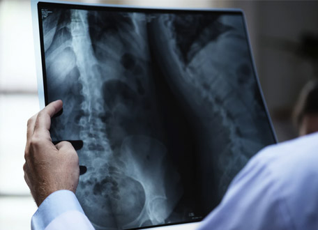  هل أنت عرضةً للتسبب بالأذى لنفسك؟